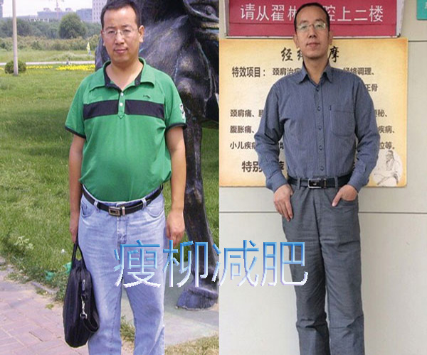 瘦柳减肥加盟
