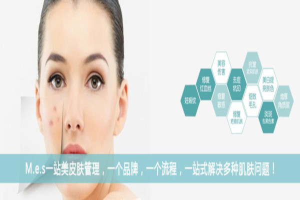 MES皮肤管理