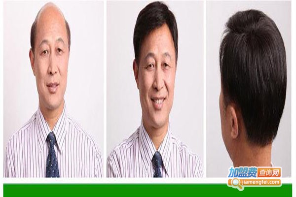 韩美黛织发补发加盟费