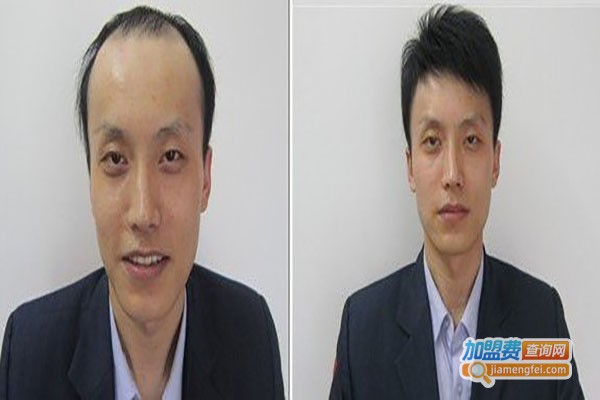 韩美黛织发补发加盟费