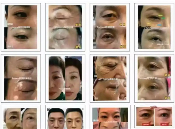 优仙眼部抗衰